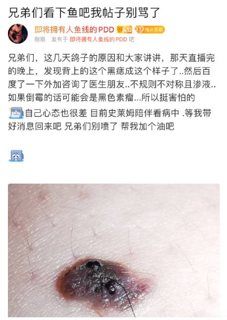 免费资料-资料大全和患瘤拒上夜班被开除与患瘤拒上夜班被开除有赔偿吗